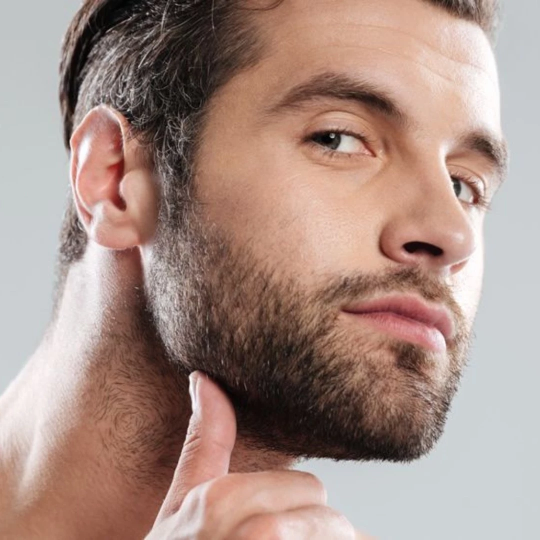 Depilación Láser Barba hombre