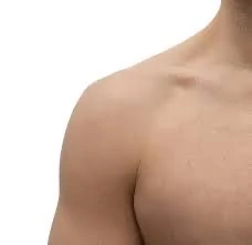 Depilación Láser Hombros hombre