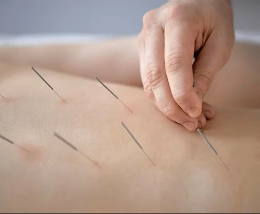 Canet Medicina Tradicional China