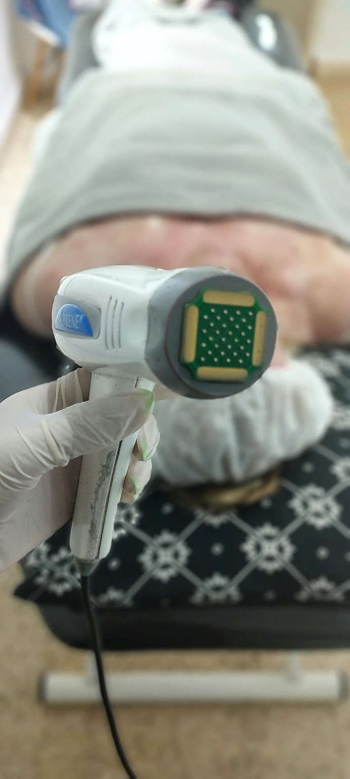 RFF: rostro, panza y brazos