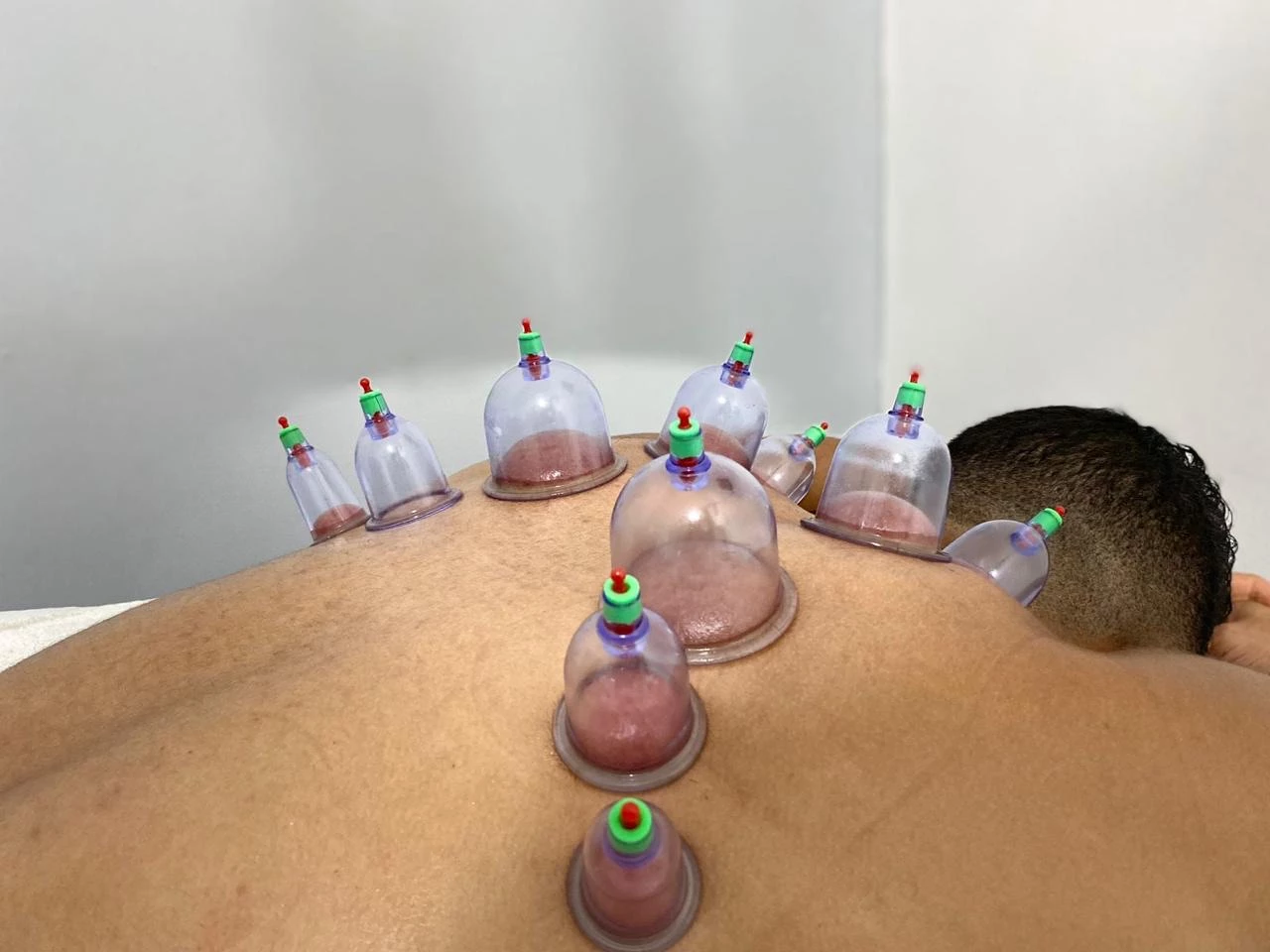 Fisioterapia del Dolor de Espalda