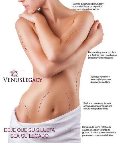 Radiofrecuencia  Venus Legacy
