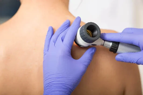 Control Dermatológico