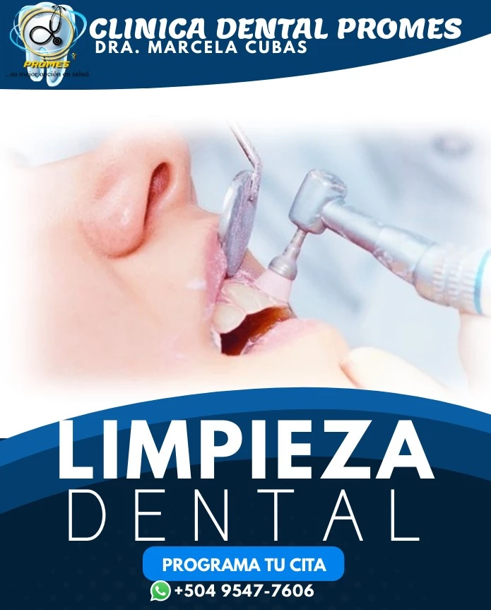 Limpieza Dental