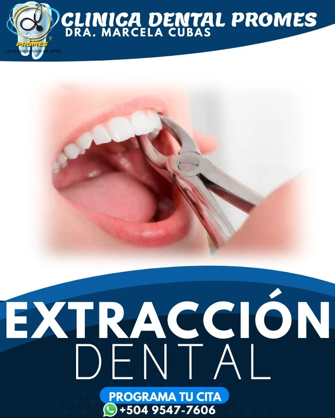 Extracción Dental