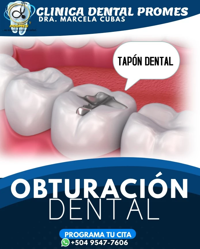 Obturación Dental