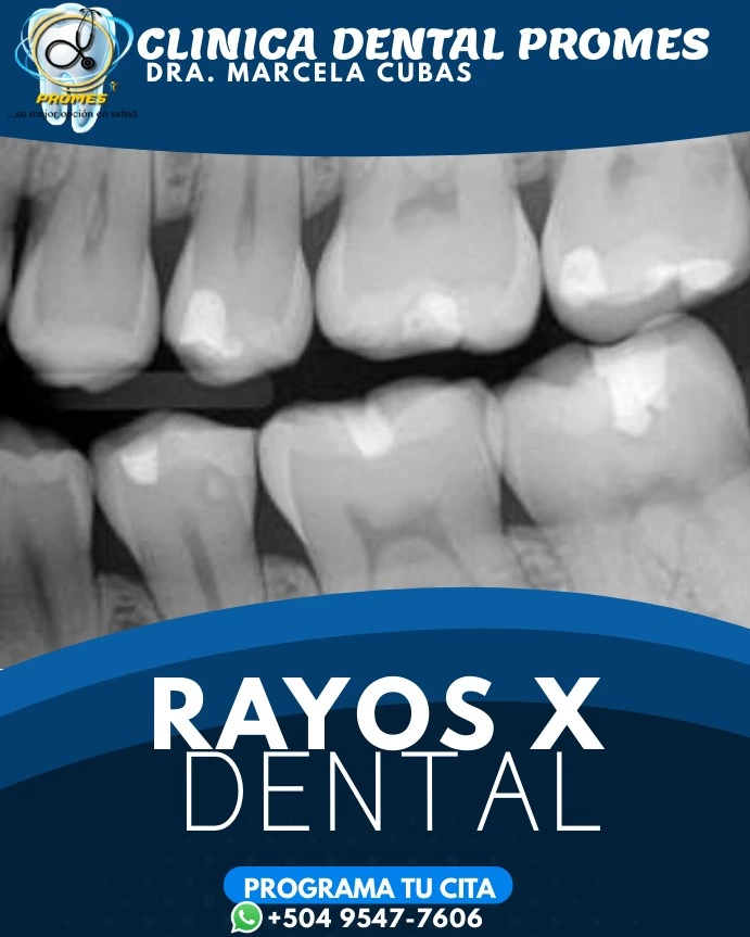 Rayos X Dental