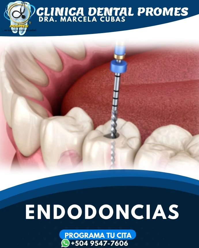 Endodoncia