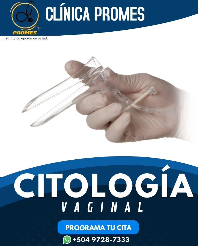 Citología Vaginal