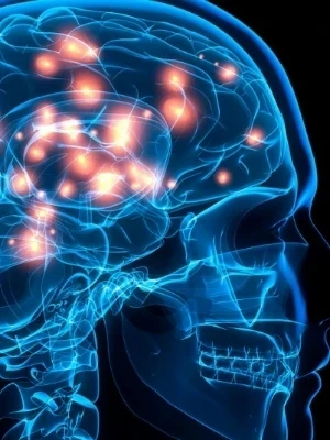 Consulta con Neurólogo