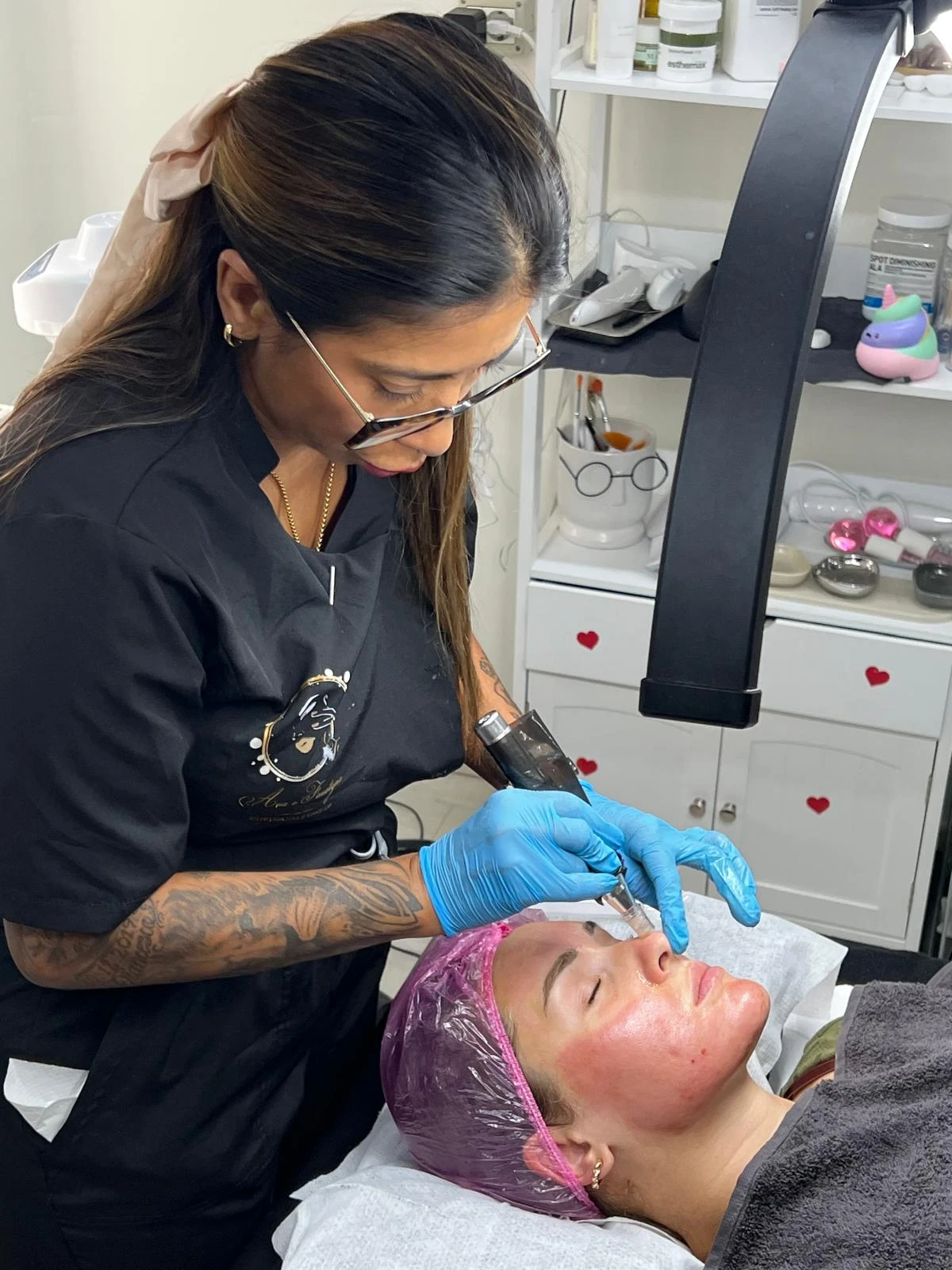 Microneedling 
