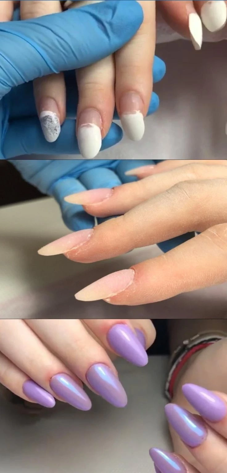 Refil gel