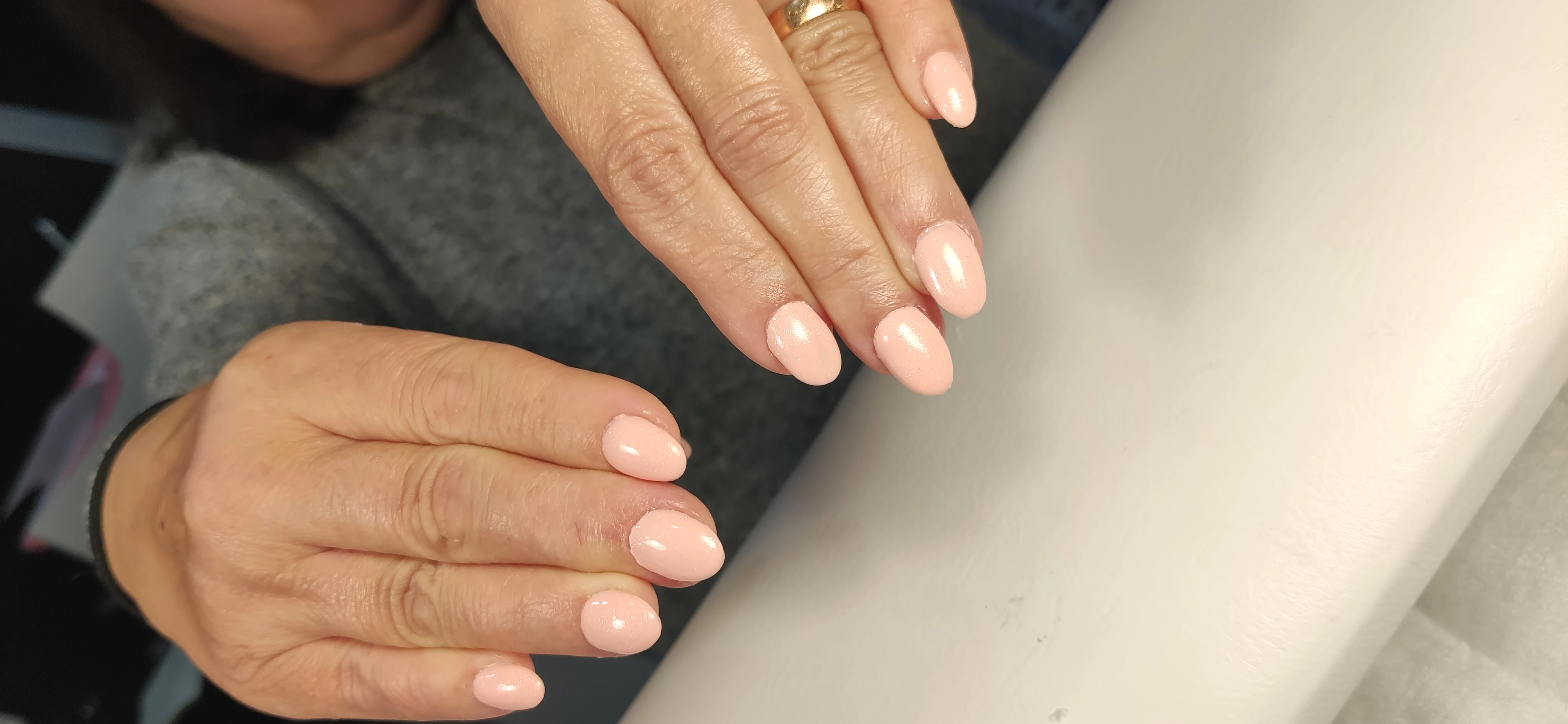 Tratamiento uñas mordidas