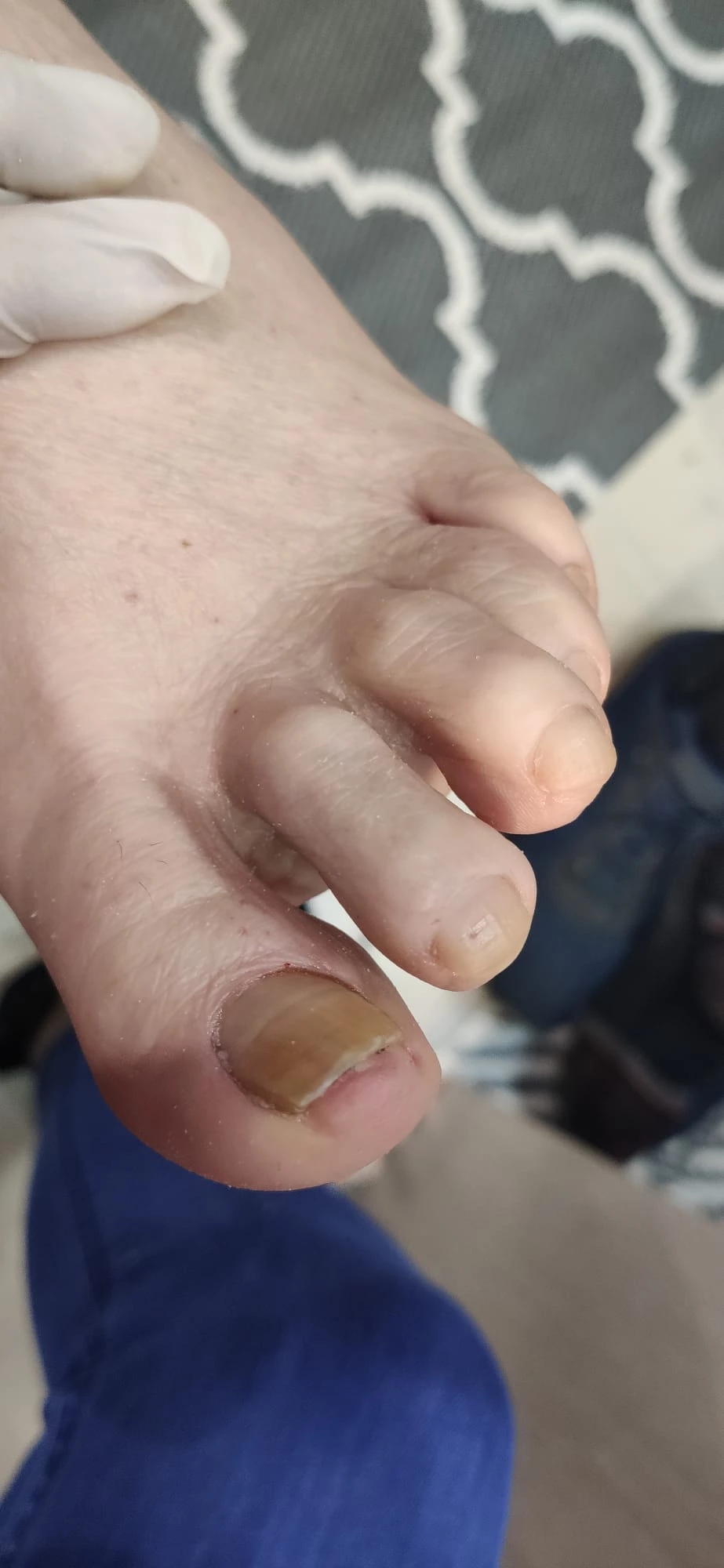 Pedicura sin color