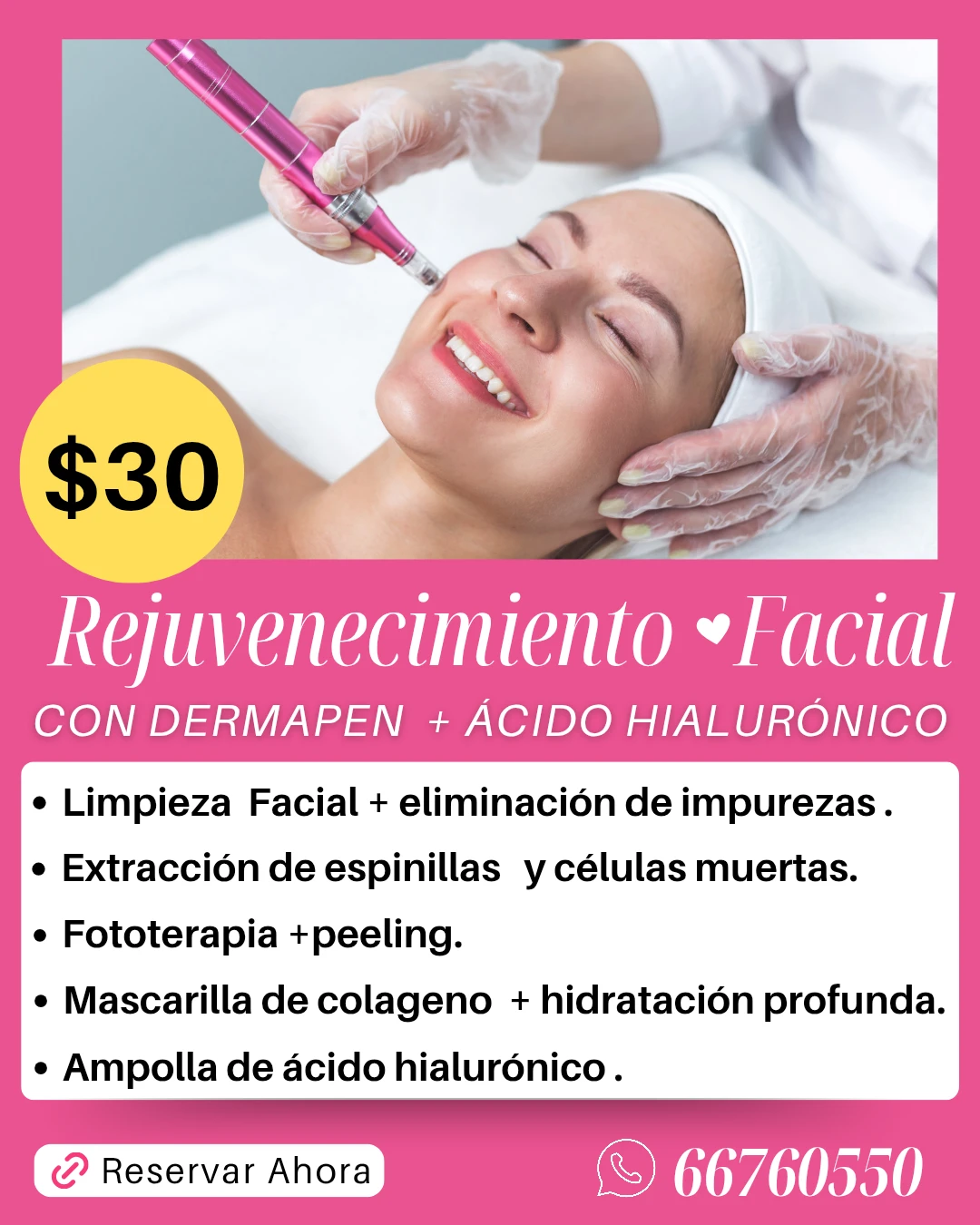 Facial rejuvenecimiento con dermapen